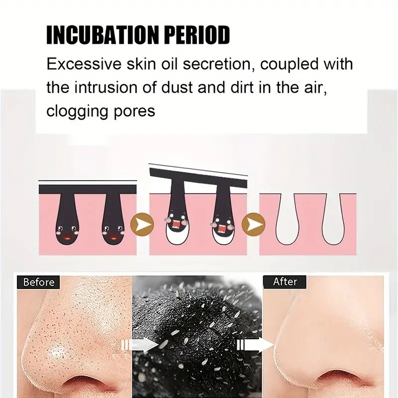 Unisex Blackhead Remove Mask N - Skincare Viral Tiktok ulasan dan harga