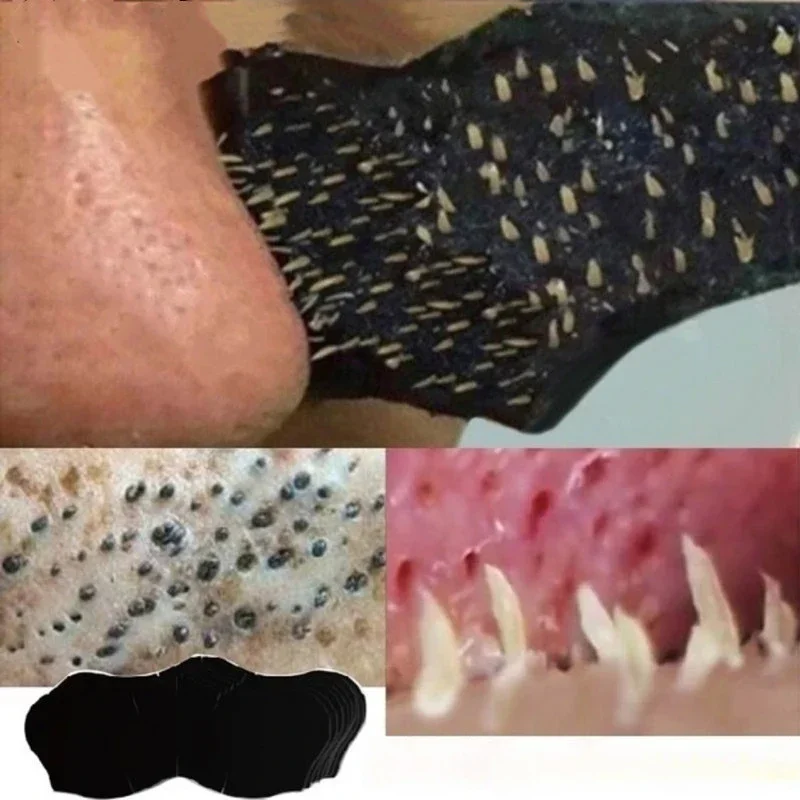Unisex Blackhead Remove Mask N - Skincare Viral Tiktok ulasan dan harga