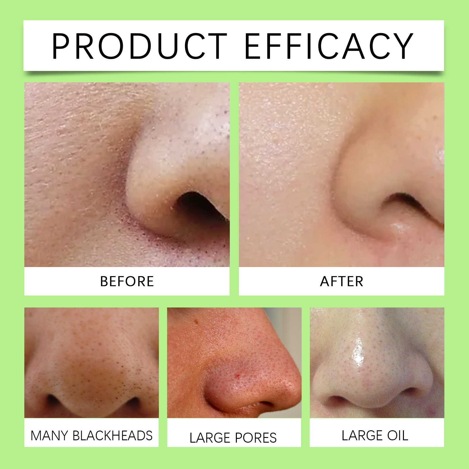 Bamboo Charcoal Nose Strips fo - Skincare Collagen ulasan dan harga