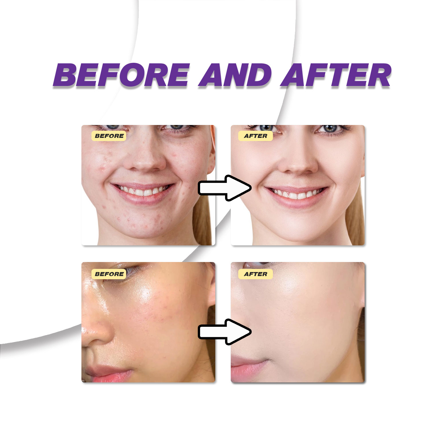 Mild Azelaic Acid Cream Improv - Skincare Skintific ulasan dan harga