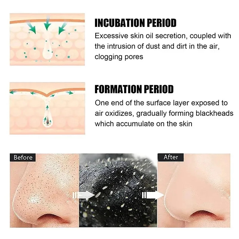10/150PCS Blackhead Remove Mas - Skincare Viral Tiktok ulasan dan harga
